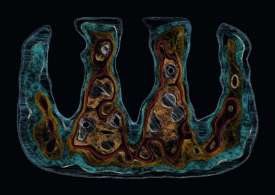 Cross-section illustration of a jaw showing teeth, roots, gums, bone, and surrounding tissue in vivid colors.